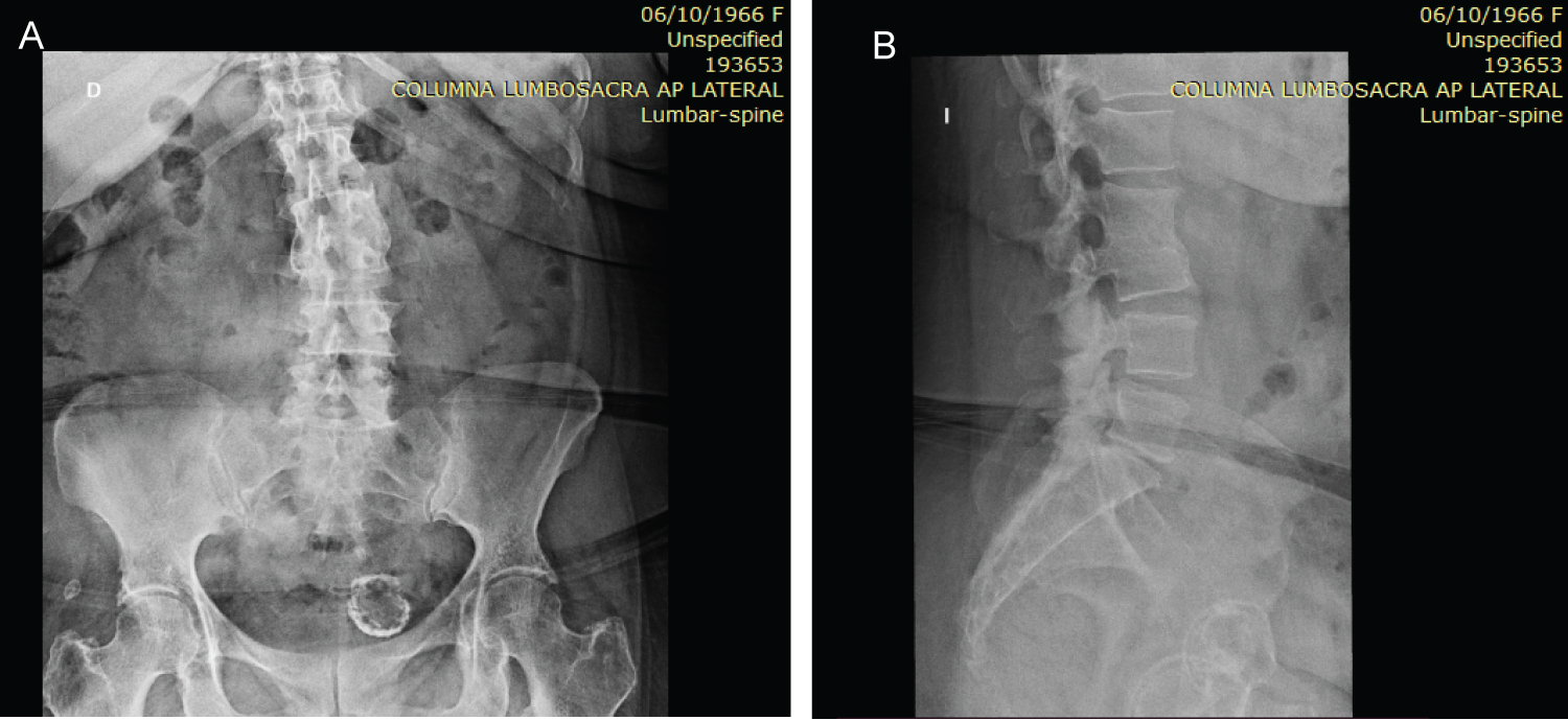 The 2026 L2 Consolidation: An OBSDN Trade Analysis of Infrastructure Costs and Yield Strategies